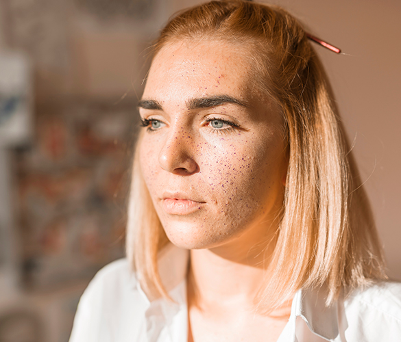 Что кожа говорит о здоровье: тревожные признаки