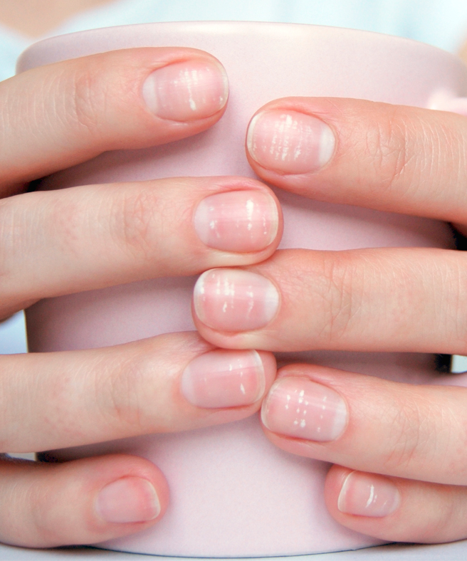 Дерматолог объяснила, из-за чего на ногтях появляются белые пятна