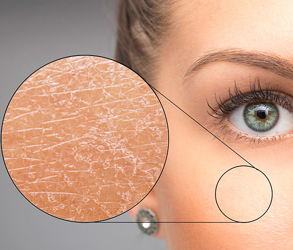 Когда кожа обезвожена: главные сигналы, которые нельзя игнорировать