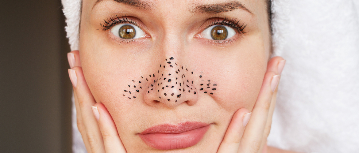 Как избавиться от черных точек: руководство для чистой и гладкой кожи 